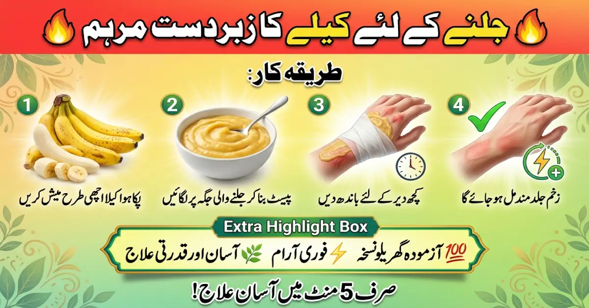 جلنے کے لئے مرہم